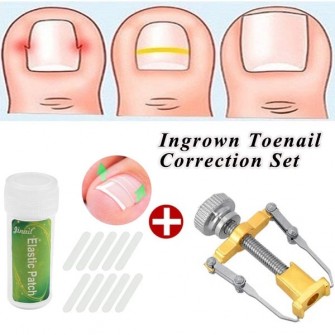 Stainless Steel Ingrown Toe Nail Correction Tool +10Pcs Nail Correction Patch Nails Art Equipment Tool