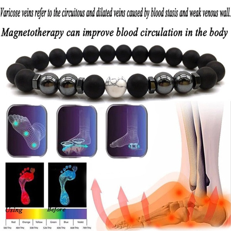 Weight Loss Magnet Anklet Colorful Stone Magnetic Therapy Bracelet Weight Loss Product Slimming Health Care Jewelry
