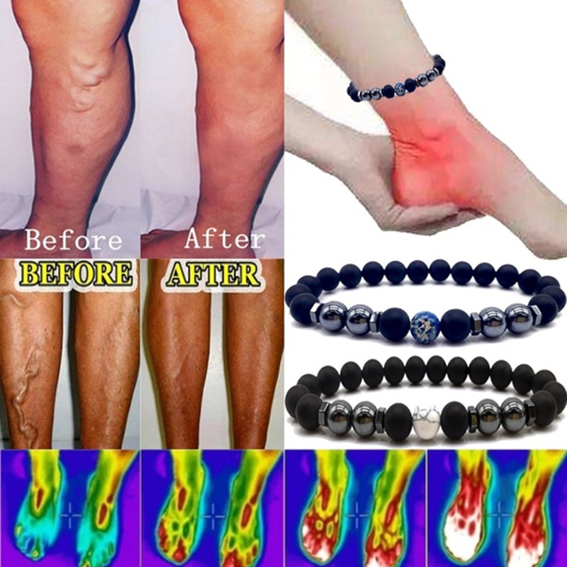 Weight Loss Magnet Anklet Colorful Stone Magnetic Therapy Bracelet Weight Loss Product Slimming Health Care Jewelry