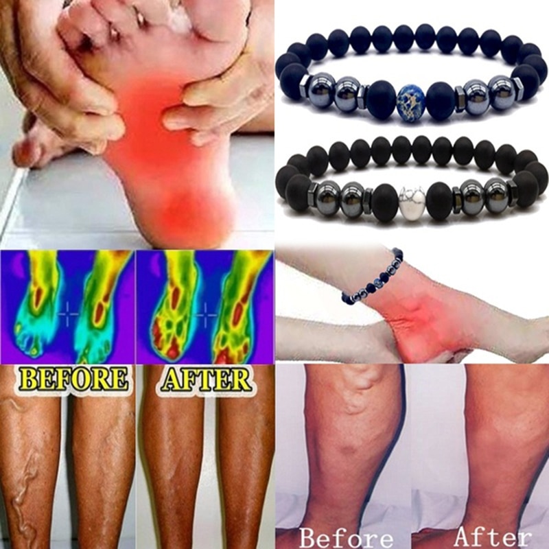 Weight Loss Magnet Anklet Colorful Stone Magnetic Therapy Bracelet Weight Loss Product Slimming Health Care Jewelry