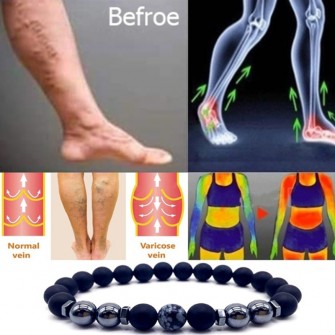 Magnet Anklet Colorful Stone eight Loss  Magnetic Therapy Bracelet Weight Loss Product Slimming Health Care jewelry