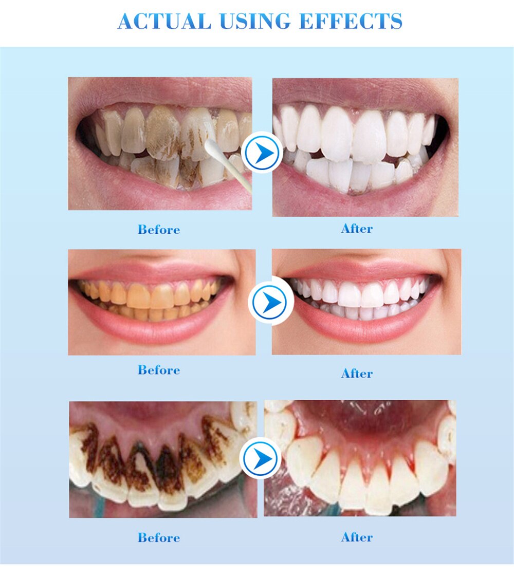 Teeth Whitening Serum Gel Dental Oral Hygiene Effective Remove Stains Plaque Teeth Cleaning Essence Dental Care Toothpaste