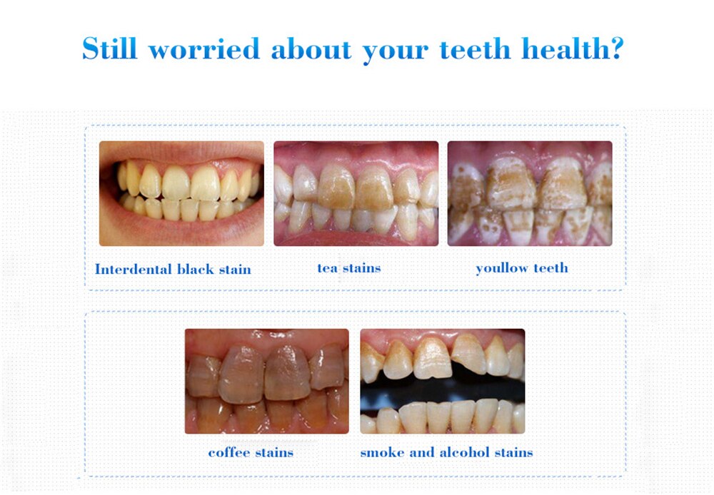 Teeth Whitening Serum Gel Dental Oral Hygiene Effective Remove Stains Plaque Teeth Cleaning Essence Dental Care Toothpaste