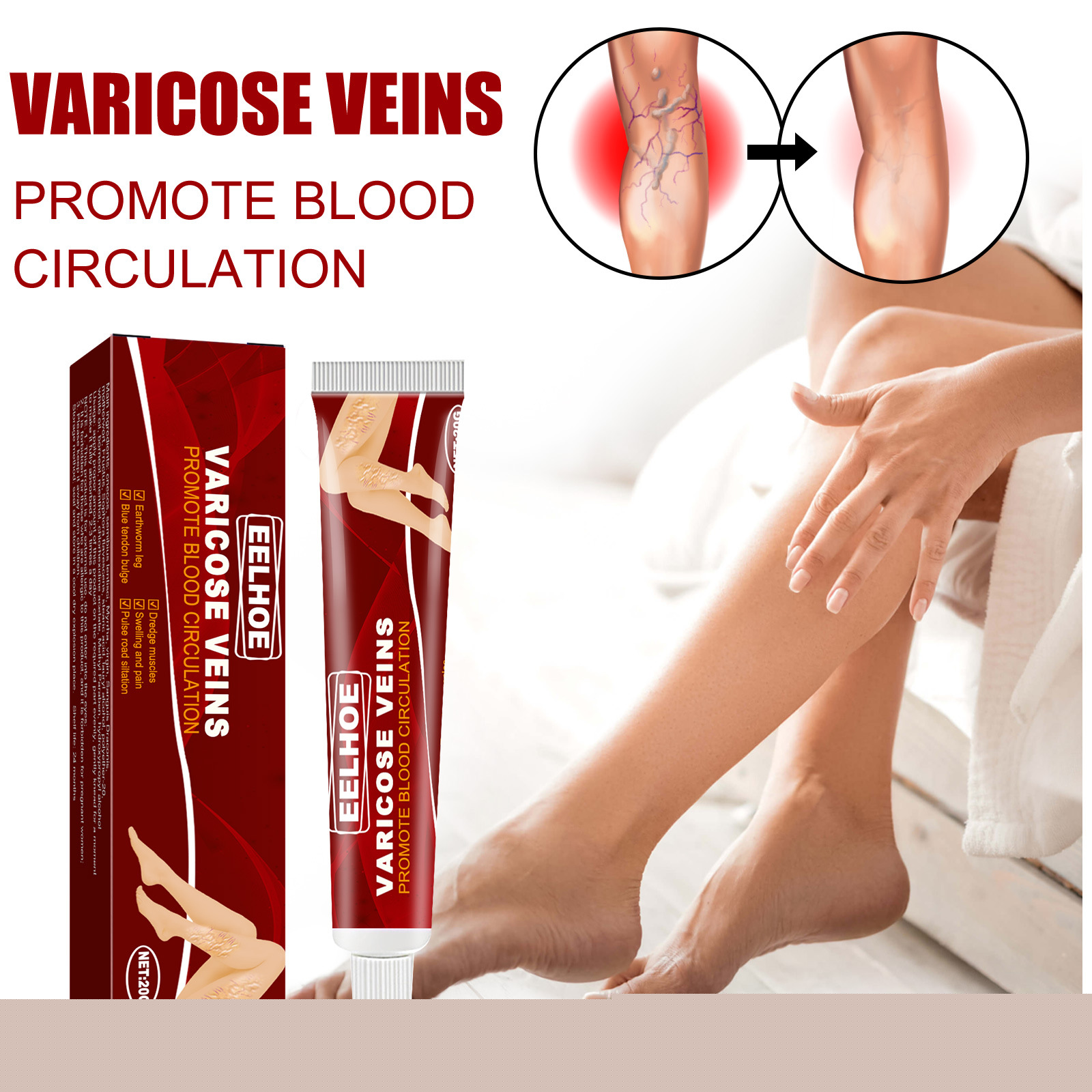 Varicose Veins Relief Cream Vasculitis Phlebitis Spider Pain Relief Ointment Medical Plaster Varicose Veins Treatment Body Cream